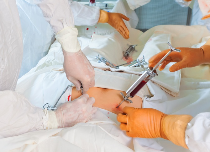 Bone marrow and stem cell transplantation
