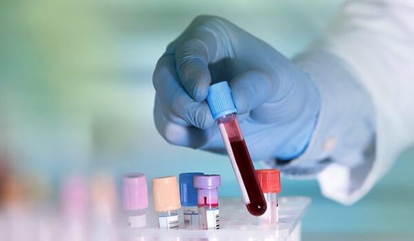 Hematology
