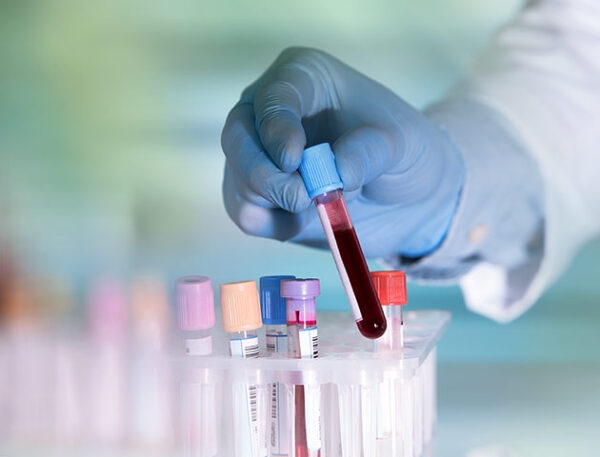 Hematology